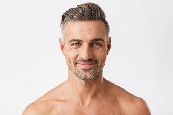 Remodelage des contours du visage – Medesthétique