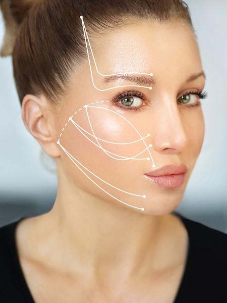Lifting du visage par fils tenseurs – Medesthétique