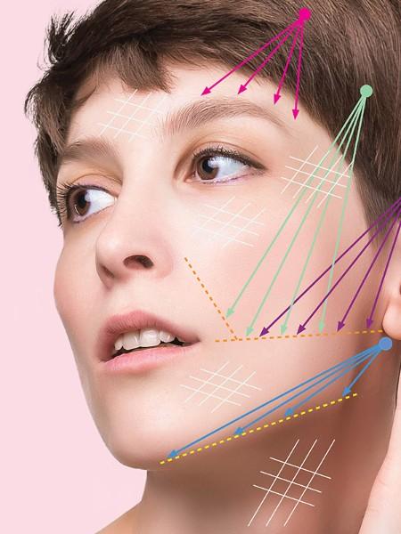 Lifting du visage par fils tenseurs – Medesthétique