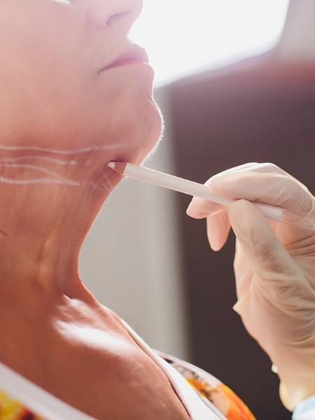 Lifting par Radiesse – Medesthétique