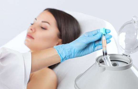 Plasma riche en plaquettes (PRP) – Medesthétique