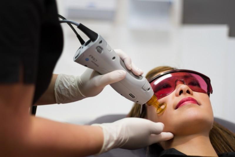 Traitement de la couperose au laser – Medesthétique