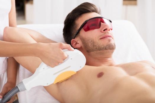 Épilation laser des aisselles chez l'homme – Medesthétique