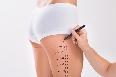 Chirurgie esthétique à Liège – Medesthétique