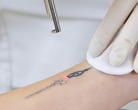 Médecine esthétique à Liège – Medesthétique